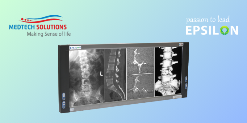 X-Ray Fim viewer (View Box) Quadra Film